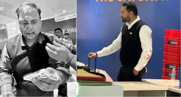 खून से सना चेहरा देख सदमे में आई 7 साल की बेटी