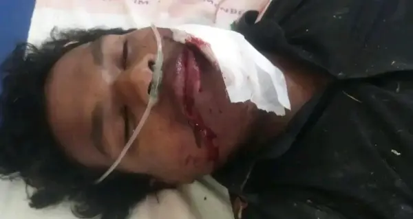 बकेली निवासी महिला और दो युवकों की गई जान।